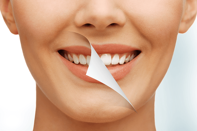 Northampton Dental Group, PC - Teeth Whitening